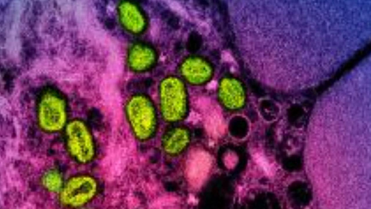 Mpox particles (coloured green) in an infected cell as viewed under the microscope. Picture: AFP PHOTO / National Institute of Allergy and Infectious Diseases