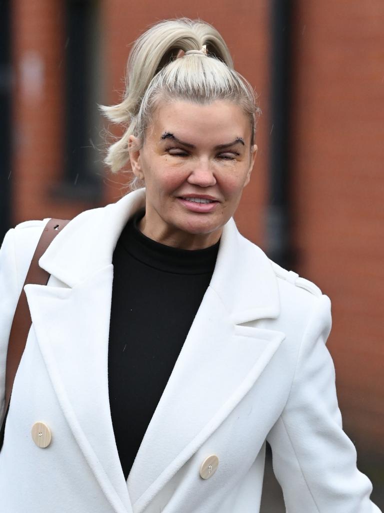 Jaw-dropping Photos Of Atomic Kitten Star Kerry Katona Post-eyelift ...