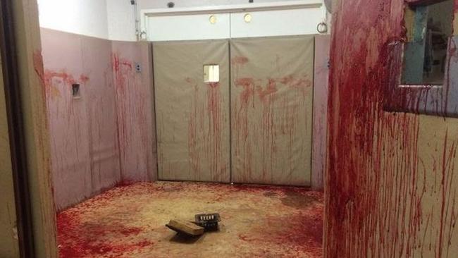 CREDIT: Imgur/Rod_Of_Asclepius My friend is a veterinarian. A horse had a nose bleed and it looks like something out of a horror movie.