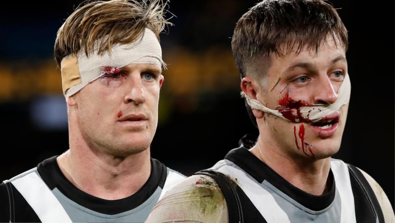 Port pair Tom Jonas and Zak Butters were left bloodied during the clash with the Tigers.