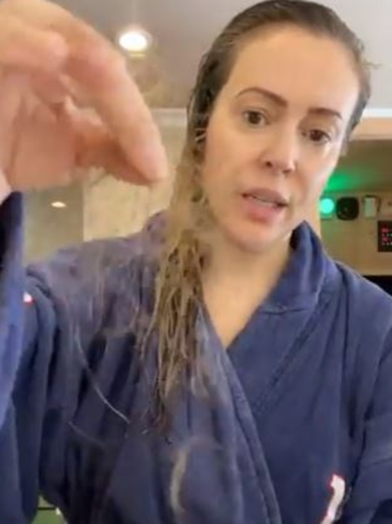 Alyssa Milano reveals her coronavirus hair loss.