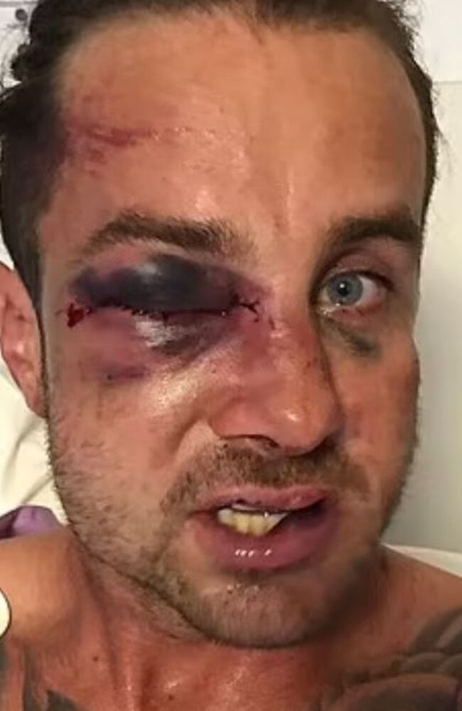 Brisbane father Josh Jones, 35, who was left hospitalised after being allegedly assaulted at a junior rugby league game on Sunday. Picture: Supplied