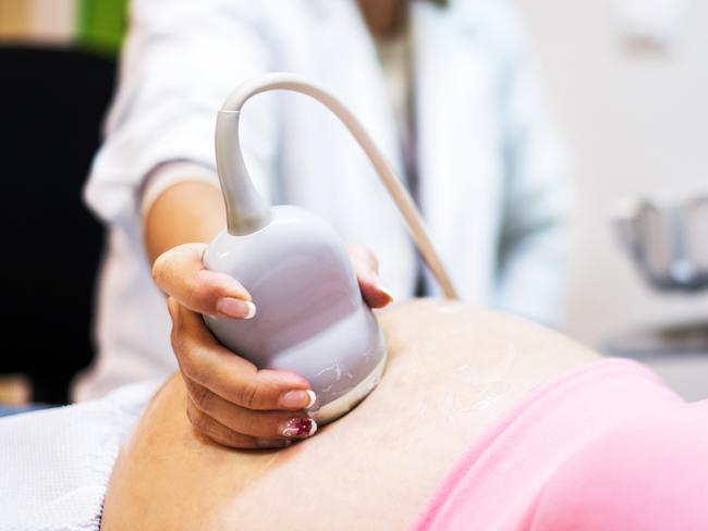 Gynecologist using ultrasound on pregnant woman. Picture: istock