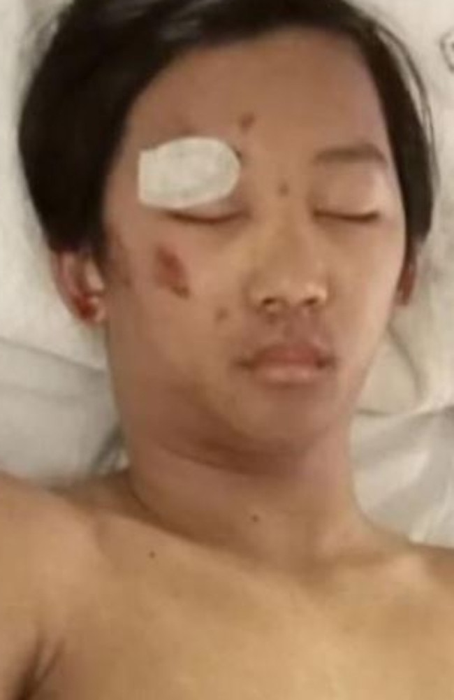 Glen Eira College student Benjamin Phikhohpoom after the abduction. Picture: 10 news