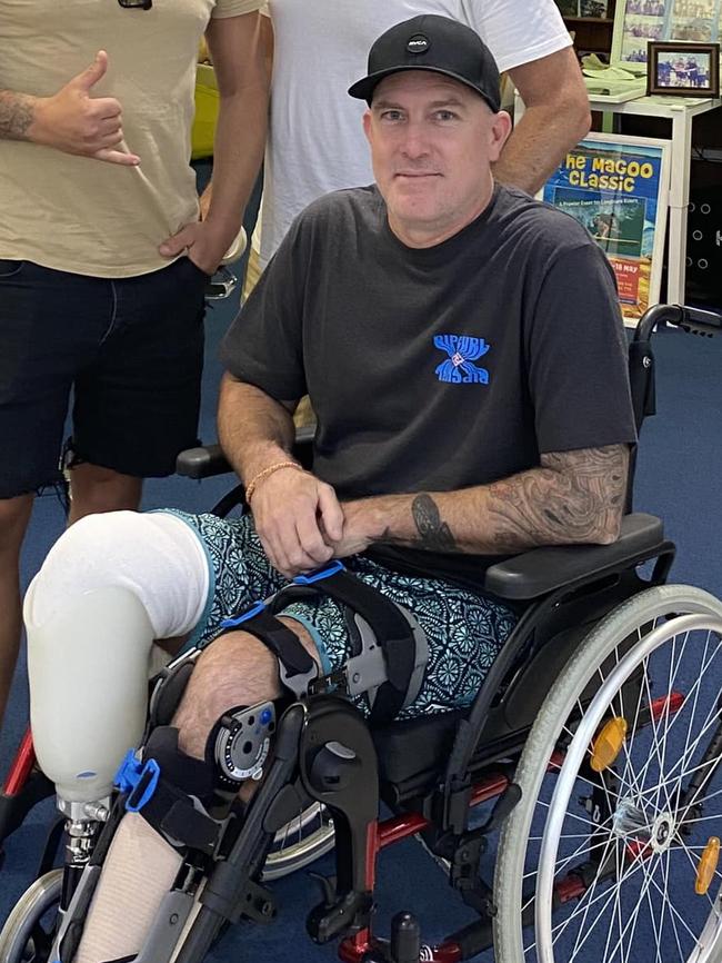 Toby Begg was attacked by a great white shark while surfing in August.