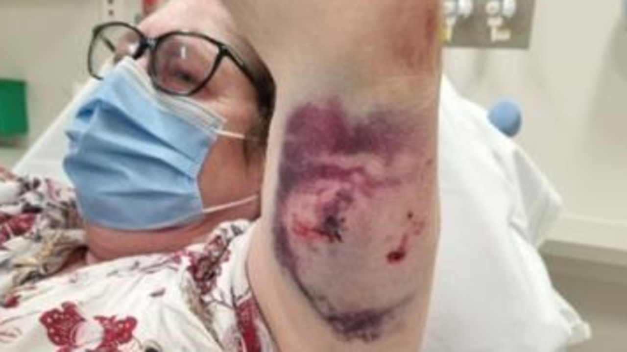 A grandmother was taken to hospital after a dog attack.