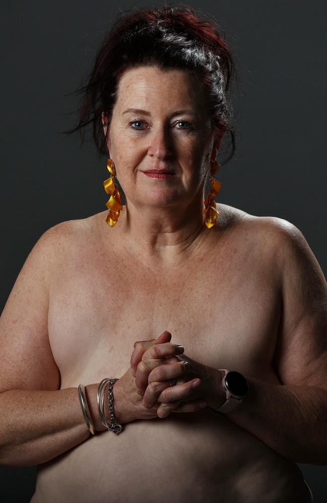 Tracy Chapman poses for a portrait. She has been waiting 1400 days for reconstruction surgery after having a double mastectomy. Picture: Tara Croser