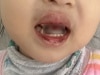 My girl was injured at daycare and they won't tell me how