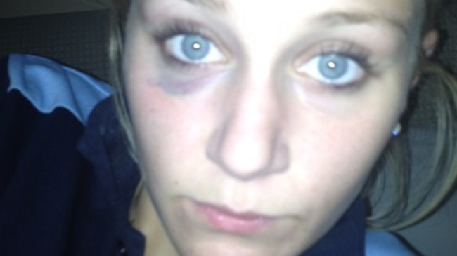 Black eyes and bruises came with the hard training.