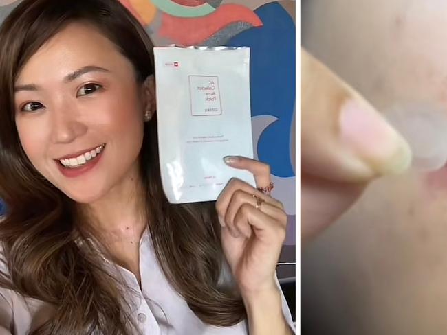 For those with acne prone skin, these pimple patches will be your bestfriend. Picture: TikTok/@alice_in_flowerland, @doublewks