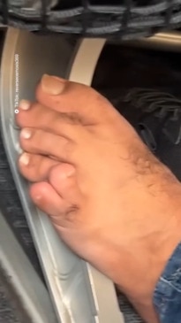 Viral footage of man’s toes shocks