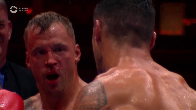 Mairis Breidis appeared to have a broken nose. Photo: DAZN.