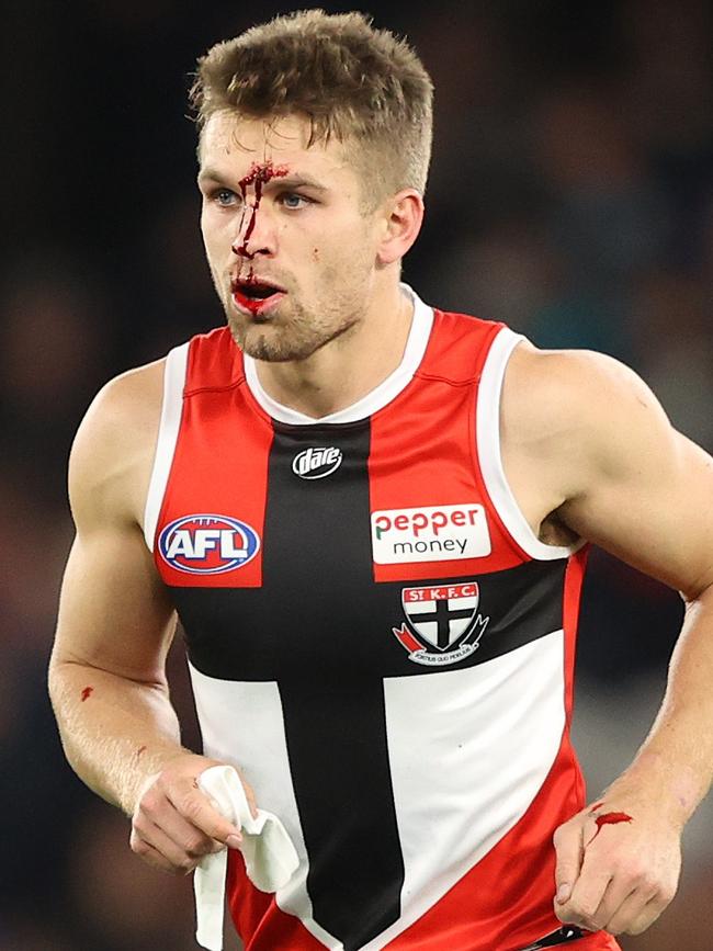 Dan Butler came off better. (Photo by Robert Cianflone/Getty Images)