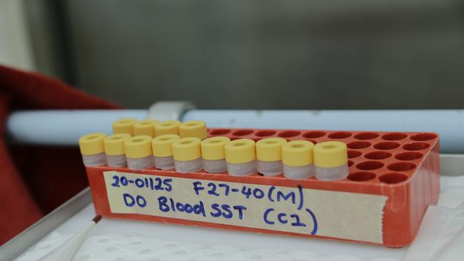 COVID-19 vaccine candidates are being tested for efficacy. Picture: CSIRO