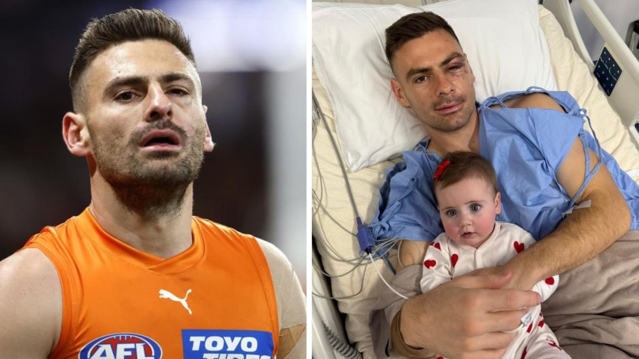 AFL veteran shares brutal photos after post-season surgeries