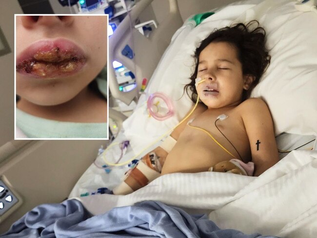 Mum's heartfelt plea after daughter hospitalised from common illness. Picture: Supplied