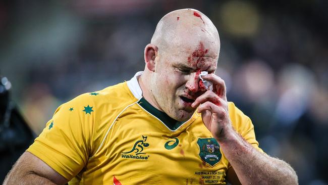 Aussie battler. Stephen Moore nurses a bleeding face.