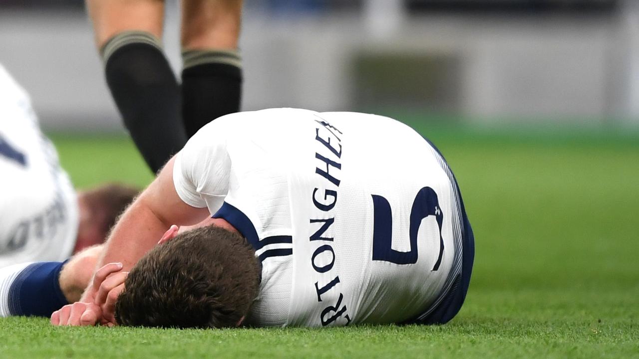 Jan Vertonghen was left dazed and bloodied following the horror head clash in the Champions League.