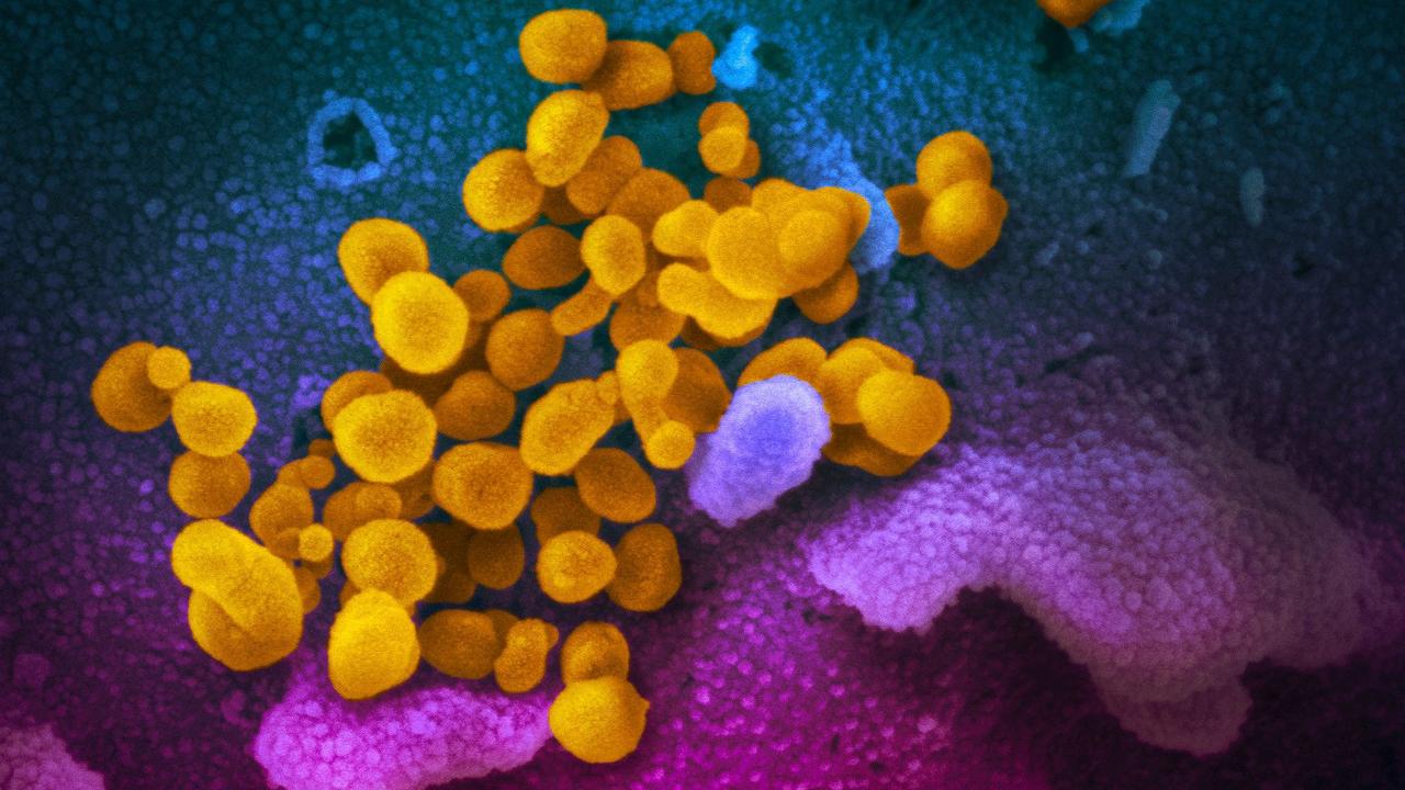 New research has suggested that coronavirus could infect people’s brains. Picture: AFP Photo/National Institutes of Health/NIAID-RML/Handout