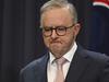 Devil in the details as Albo caught short