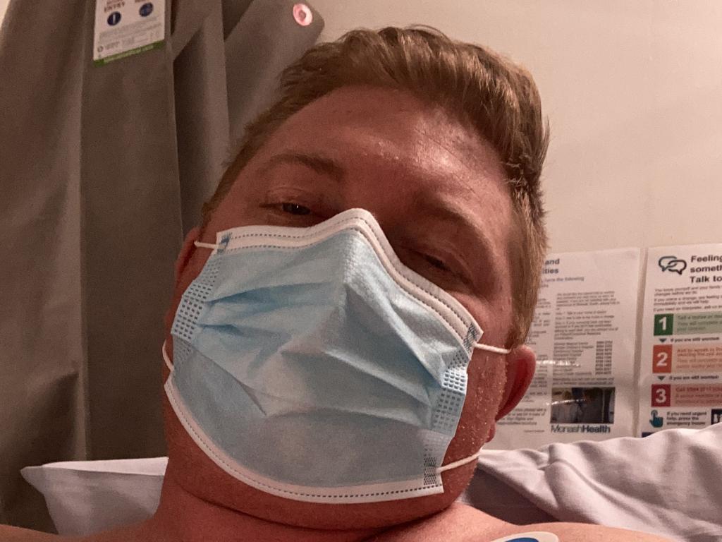 Gareth O’Gradie had open heart surgery to remove his pericardium. Picture: Supplied