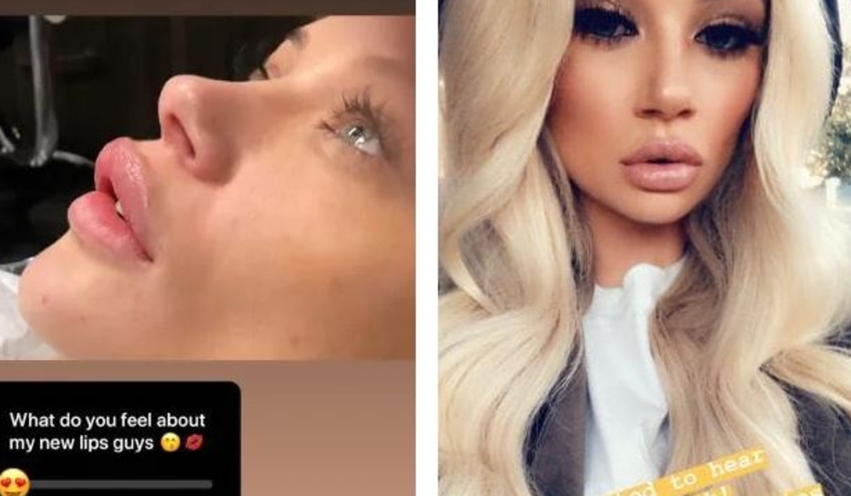 'What would you guys do if it was you?' Jess appeared upset over the backlash about her plumper lips. Picture: Instagram