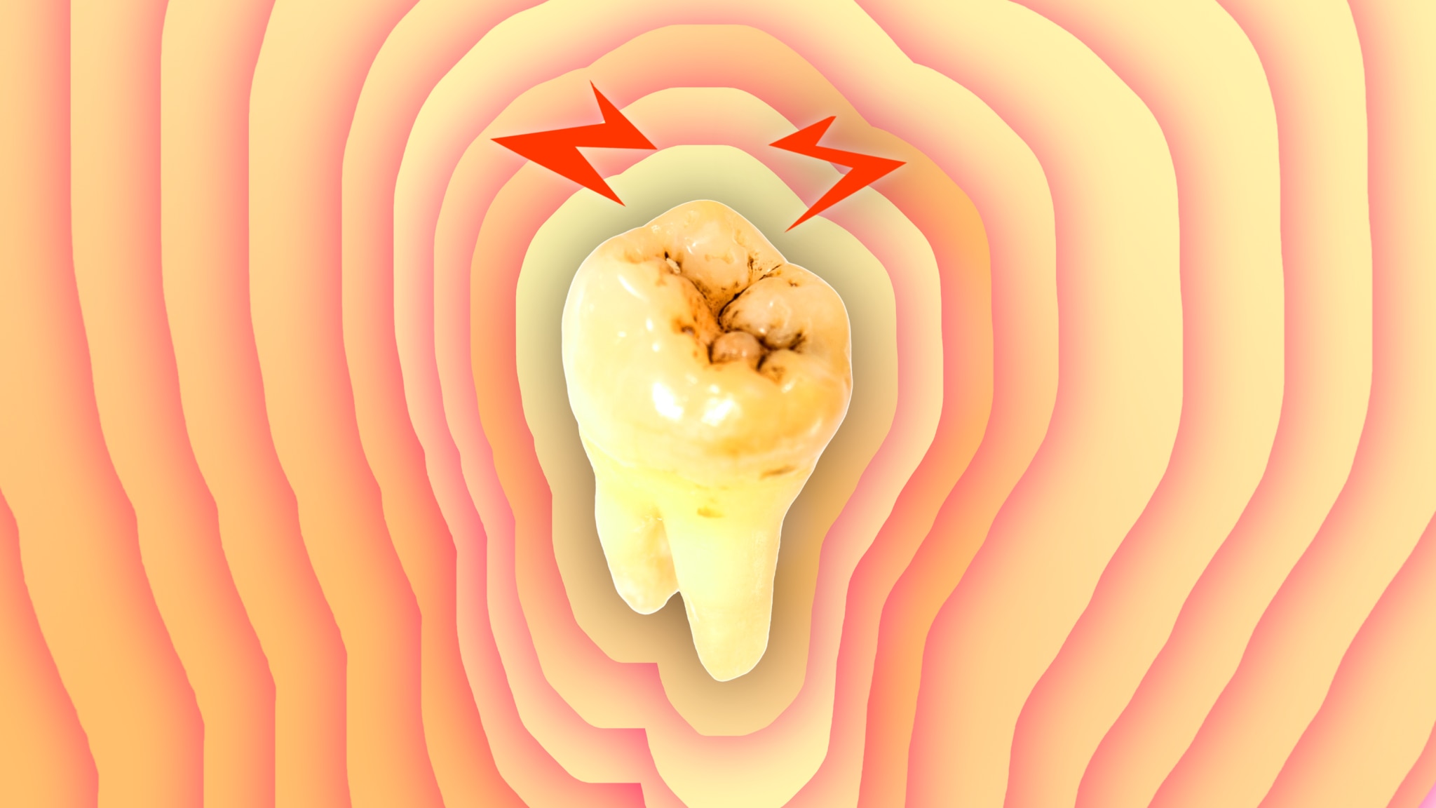 Vaping Dentists see increasing gum disease tooth decay bad