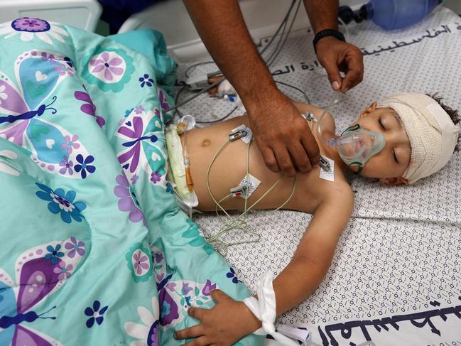 A four year old Palestinian child receives medical care at Nasser hospital in Khan Yunis in the southern Gaza Strip, following dawn Israeli bombardment in Rafah, on June 19. Picture: AFP