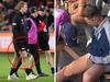‘Unprecedented’ injury toll stuns AFL world