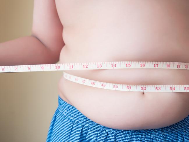 People living with obesity have an increased risk of cardiovascular disease. Picture: istock