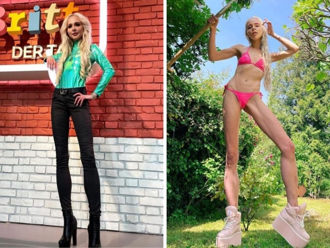 influencer who featured on Germany’s version of Celebrity Big Brother has paid $225K in order to lengthen her legs by 5.5 inches