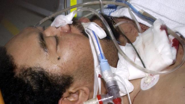 03/09/2003. An arrested Faafua (Fa'afua) Lameko, pictured on stretcher arriving at /PA /Hospital, allegedly killed his son Lorenzo, 5, and his daughter Loretta, 2, attacked his wife Piula, stabbed another baby, and killed his daughter Janelle, 4 months. He then stabbed himself. Defiance Road Woodridge multiple stabbing murders.