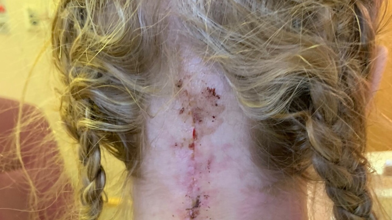 The accident has left her at risk of “internal decapitation”. Source: GoFundMe