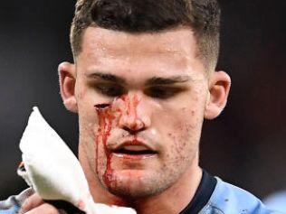 TOWNSVILLE, AUSTRALIA - JUNE 09:  Nathan Cleary of the Blues is attended to by a team trainer after a cut to his face during game one of the 2021 State of Origin series between the New South Wales Blues and the Queensland Maroons at Queensland Country Bank Stadium on June 09, 2021 in Townsville, Australia. (Photo by Ian Hitchcock/Getty Images)