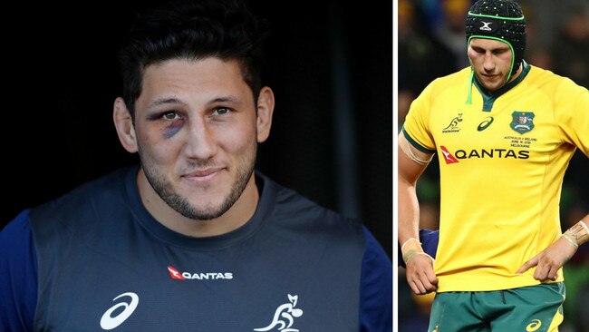 Wallabies lock Adam Coleman has a nice black eye.