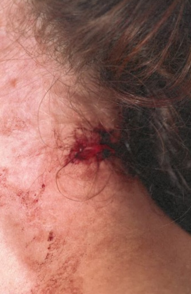 The victim displays her injuries after being assaulted by Sophia Mammone