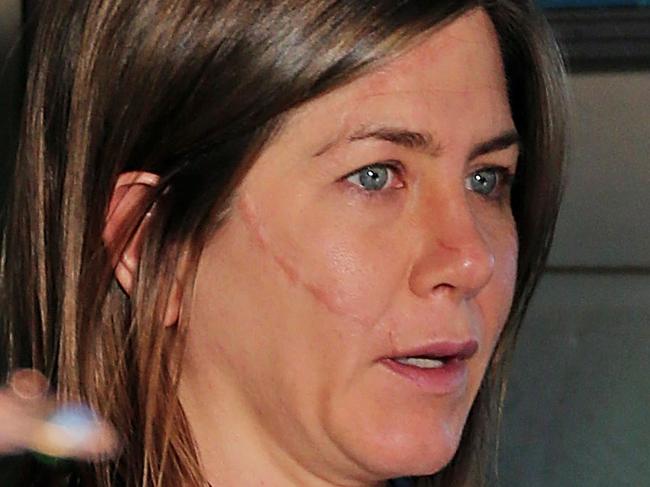 Jennifer Aniston shows off her prosthetic scars on set of 'Cake' in Eagle Rock, CA. Aniston stars along side Sam Worthington in this story about a grieving mother recovering from the aftermath of a car crash. <P> Pictured: Jennifer Aniston <P><B>Ref: SPL730971 070414 </B><BR/> Picture by: Splash News<BR/> </P><P> <B>Splash News and Pictures</B><BR/> Los Angeles: 310-821-2666<BR/> New York: 212-619-2666<BR/> London: 870-934-2666<BR/> photodesk@splashnews.com<BR/> </P>