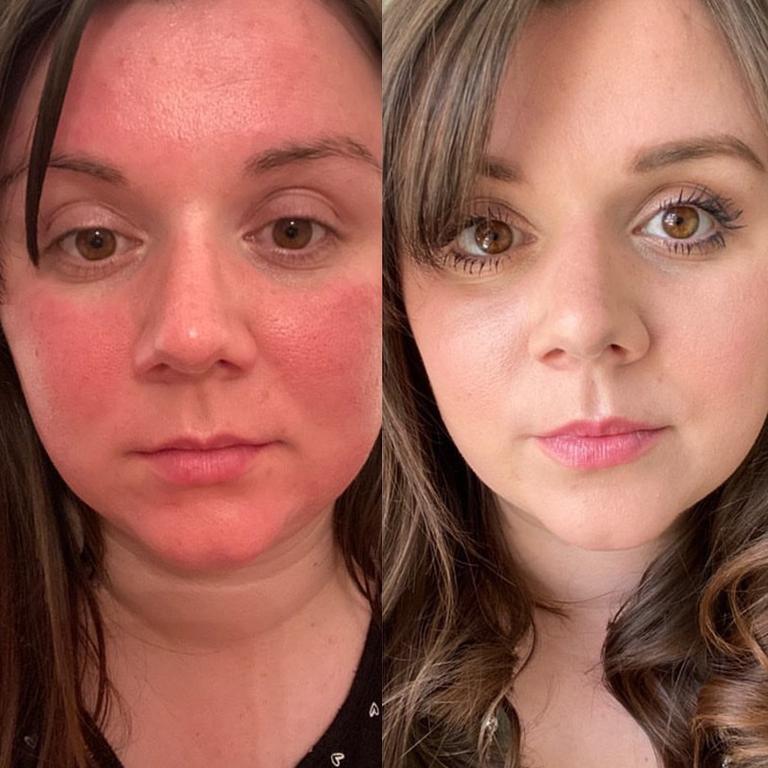 One delighted user of the Trinny London BFF Cream showed off her amazing results online. Picture: Facebook