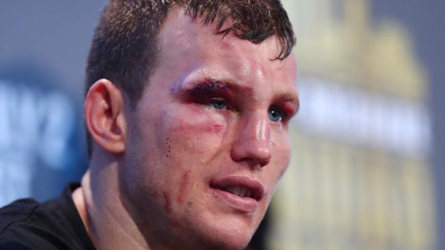 Jeff Horn has been the subject of vile social media abuse in the wake of his upset defeat of Manny Pacquiao. Picture: Getty