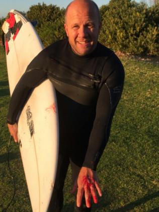 Beaches reopen as veteran surfer Max Dwyer bravely ventures back into ...