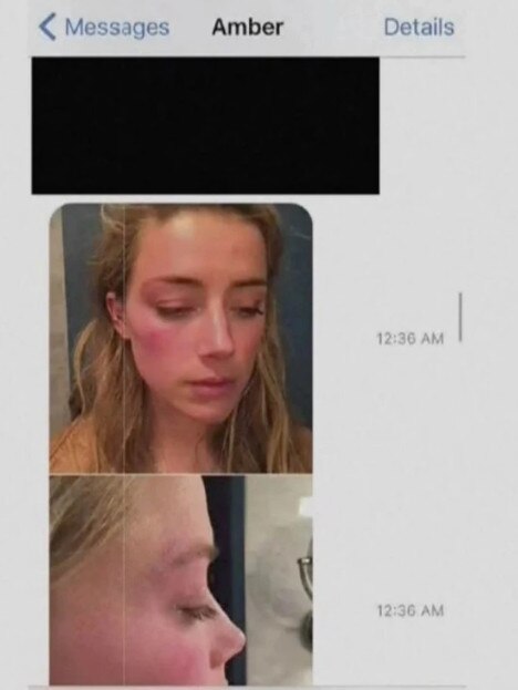 Amber Heard texted these photos to her nurse. Picture: Supplied