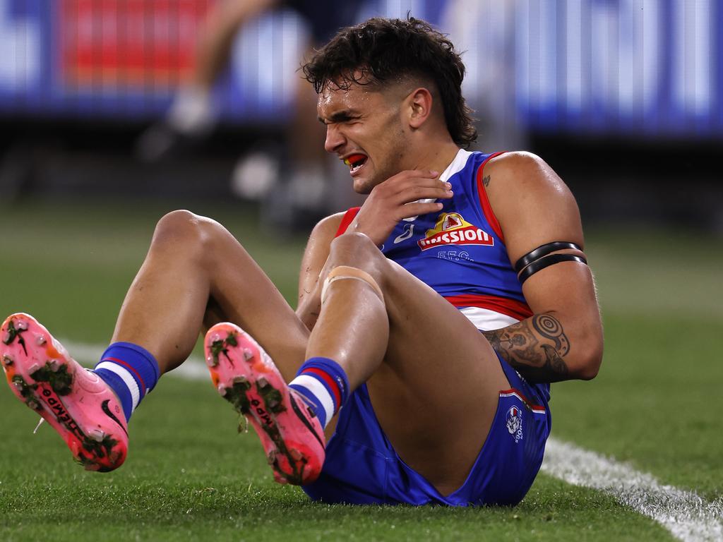 MELBOURNE, AUSTRALIA - SEPTEMBER 06:  Jamarra Ugle-Hagan of the Bulldogs grabs at his shoulder during the AFL Second Elimination Final match between Western Bulldogs and Hawthorn Hawks at Melbourne Cricket Ground, on September 06, 2024, in Melbourne, Australia. (Photo by Darrian Traynor/AFL Photos/via Getty Images)