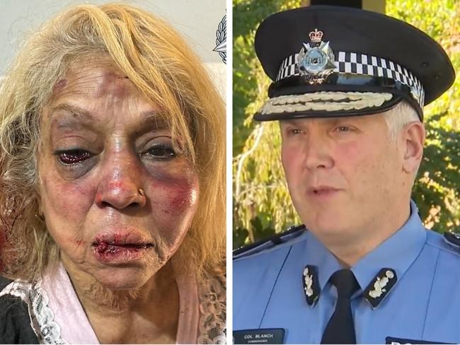 Fury as elderly Aussie beaten in home