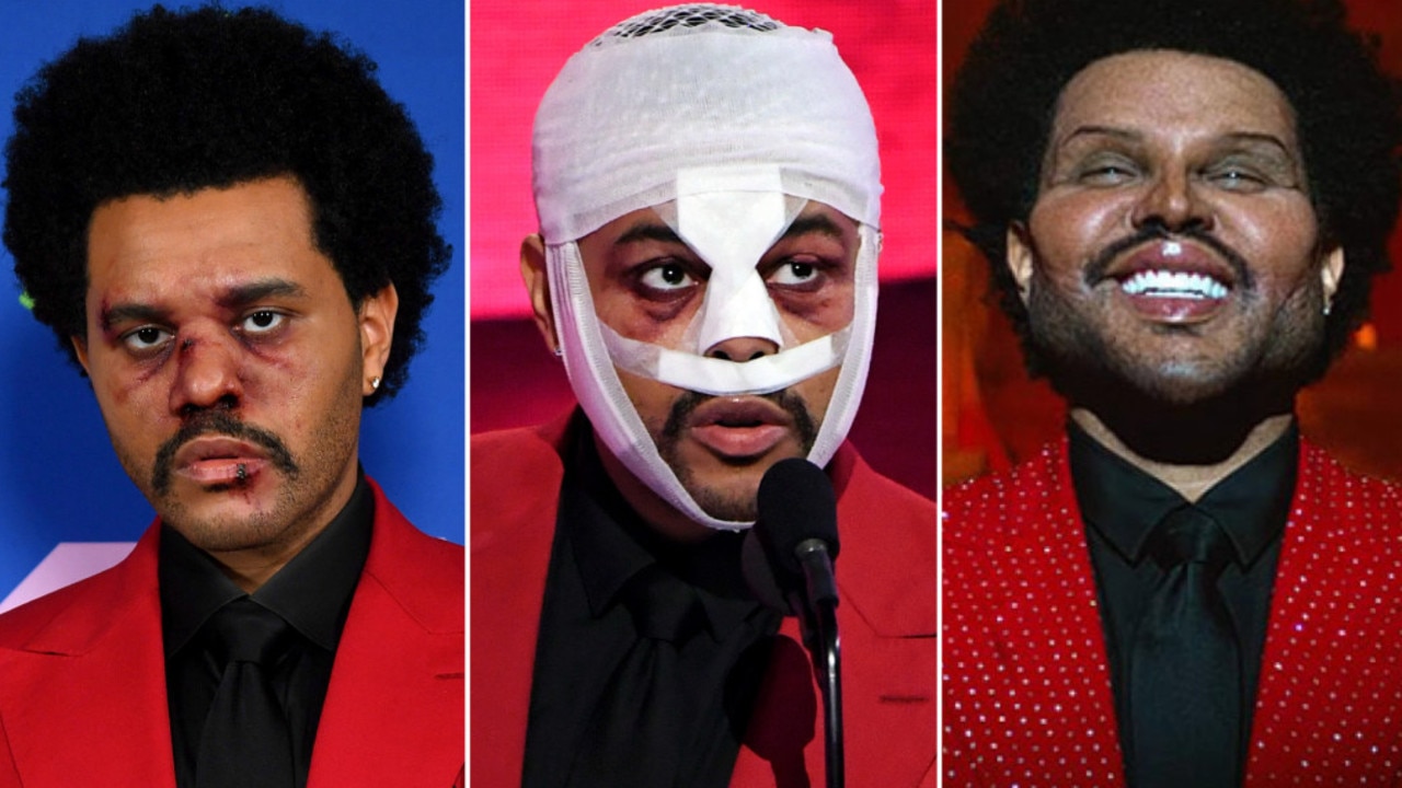 The Weeknd Finally Explains Why He's Been Wearing All Those Bandages
