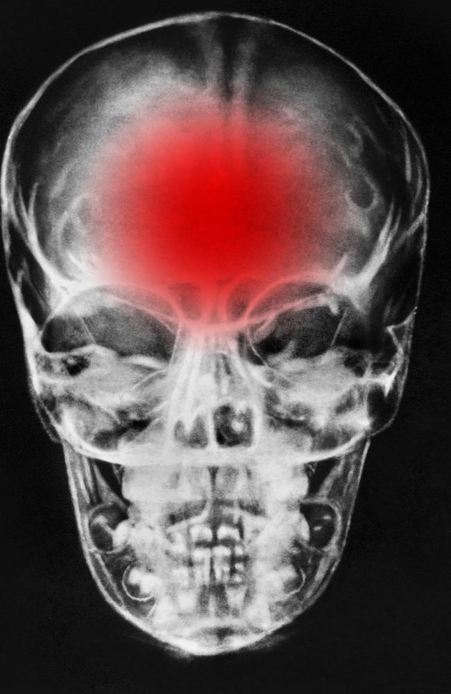 Clubs have no obligation to monitor concussion injuries throughout the season.