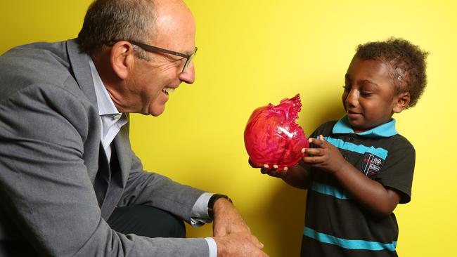 Royal Children's Hospital cranofacial Surgeon Tony Holmes shows Jack the model of his skull. Picture: Alex Coppel