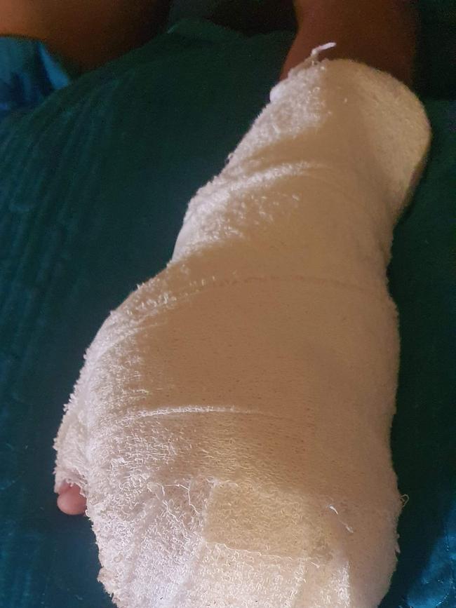 A 16-year-old boy had his pinky finger partially amputated during a ‘wounding’ attack which left him in intensive care.