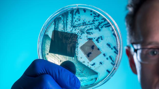 A culture of superbug analysed by Alfred researchers. Picture: Jake Nowakowski