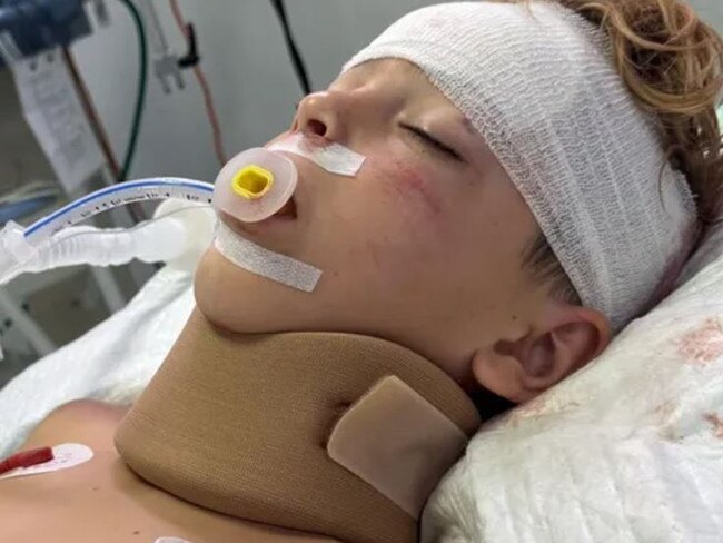 Eight year old Joshua Schuetz is fighting for life in a Bali hospital after being involved in a quad bike accident. Picture: GoFundMe