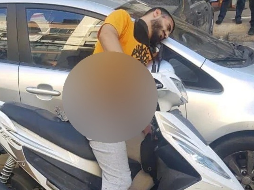 A Lebanese man injured after the pager attack.